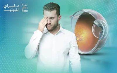 ارتشاح العين وتأثيره في الرؤية وكيفية الوقاية منه