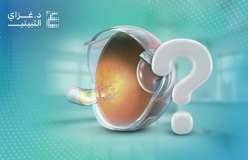 أسباب الارتشاح على العصب البصري أسباب الارتشاح على العصب البصري