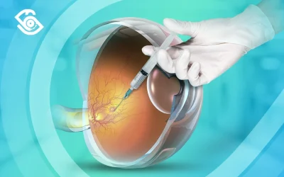 حقن العين لعلاج الارتشاح