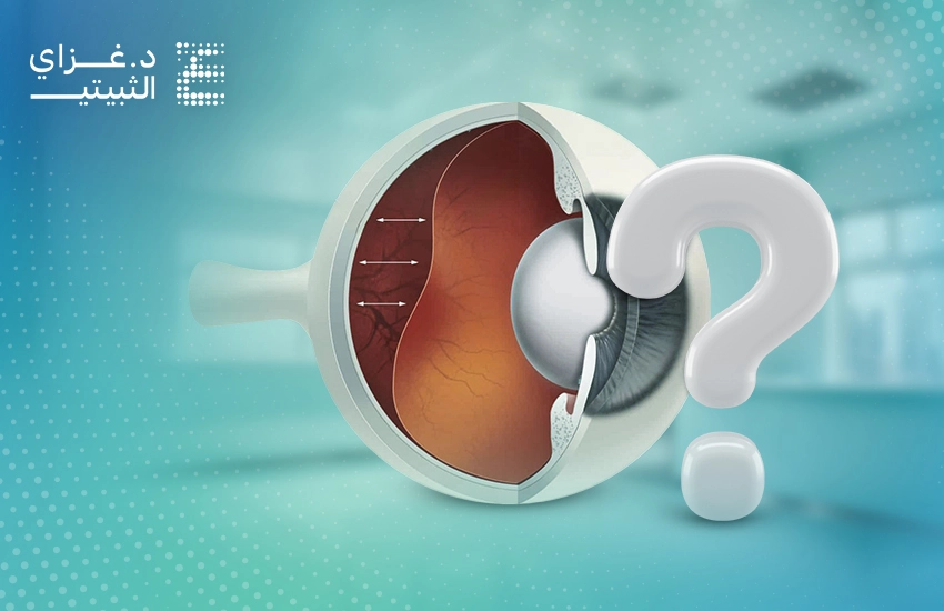 أسباب انفصال الشبكية