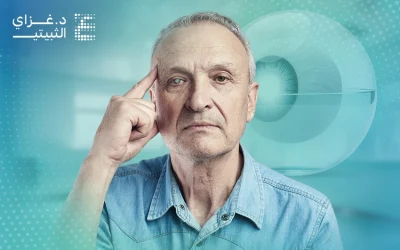 الماء الأبيض في العين | تفاصيل تهمك في رحلة التشخيص والعلاج