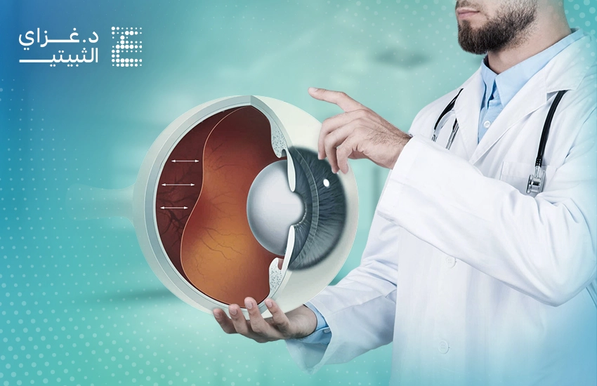 علاج انفصال الشبكية