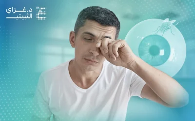أسباب ظهور ذبابة العين وأعراضها وهل خطيرة؟