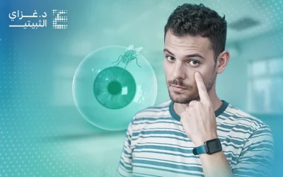 علاج الذبابة الطائرة في العين وسبل التخلص منها