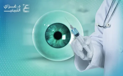 أهم إرشادات بعد حقن العين 
