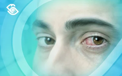 العلاقة بين مرض السكري والتهاب شبكية العين