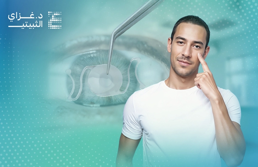 مميزات وعيوب زرع العدسات