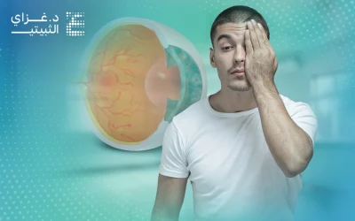 التنكس البقعي: الأعراض ووسائل التشخيص وسبل العلاج