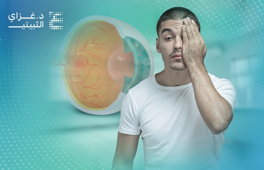 التنكس البقعي