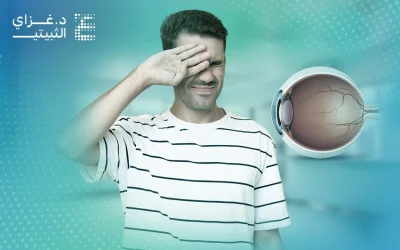 انفصال السائل الزجاجي | الأسباب والأعراض ومتى يجب زيارة الطبيب