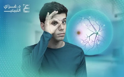 هل تبحث عن أفضل علاج لتقوية شبكية العين؟