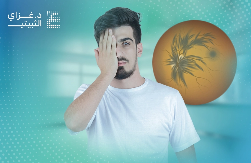 علاج انسداد الوريد الشبكي المركزي علاج انسداد الوريد الشبكي المركزي