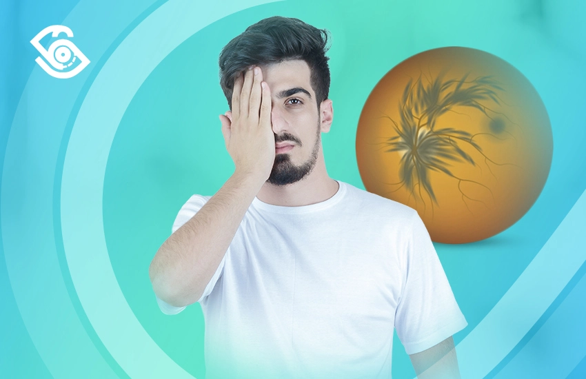 علاج انسداد الوريد الشبكي المركزي علاج انسداد الوريد الشبكي المركزي