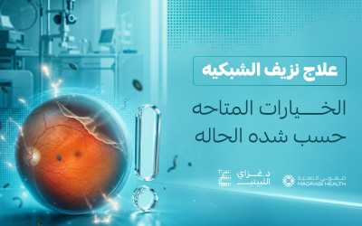 علاج نزيف الشبكية: الخيارات المتاحة حسب شدة الحالة