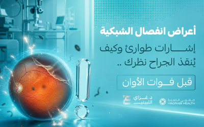 أعراض انفصال الشبكية: إشارات طوارئ وكيف يُنقذ الجراح نظرك قبل فوات الأوان